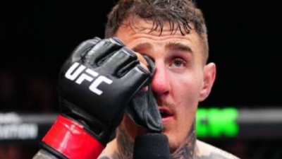 톰 아스피날, “오른쪽 눈 전혀 안 보여… 왼쪽 시력도 절반 잃었다”