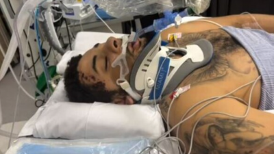 전 본머스 수비수 조던 치에도지, 음주운전 차량에 치여 다리 절단